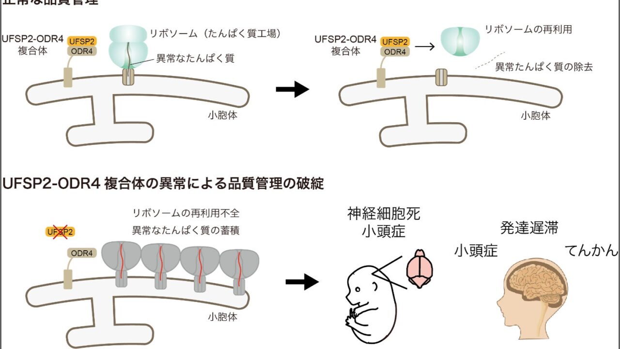 細胞内の「たんぱく質工場」を守る新品質管理システムを解明